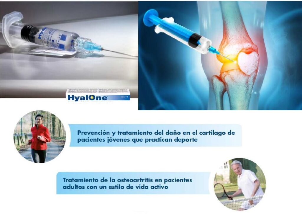 que es el ácido hialurónico